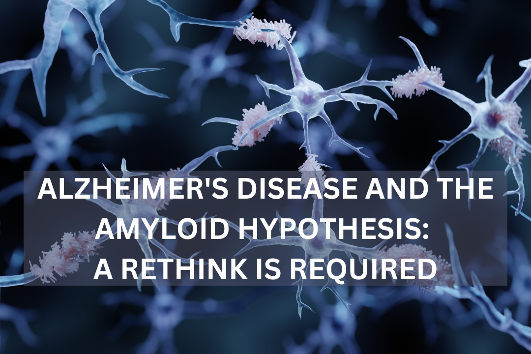 Which Of The Following Statements Is True About Alzheimer's Disease Alzheimer's Disease and the Amyloid Hypothesis: A Rethink is Required